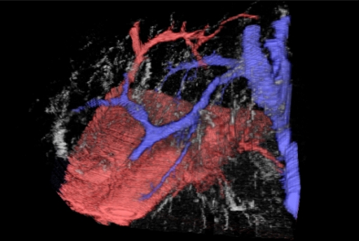 Virtual dye cast of liver microvsculature